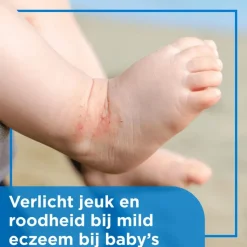 Hot Bepanthen Eczeem Crème Baby Verlicht Jeuk En Roodheid Bij Mild Tot Matig Eczeem 20 GR