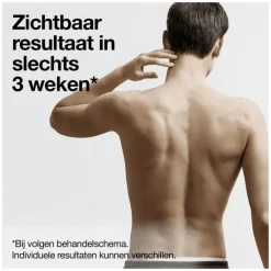 Discount Braun IPL Silk-expert Pro 5 PL5145