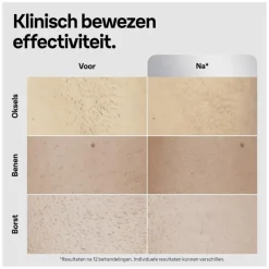 Discount Braun IPL Silk-expert Pro 5 PL5145