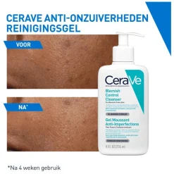 New CeraVe Anti-Onzuiverheden Reinigingsgel 473 ML