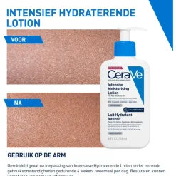 New CeraVe Intensief Hydraterende Lotion 473 ML