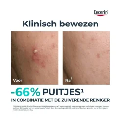 Sale Eucerin DERMOPURE CLINICAL Triple Action Fluid Serum Gevoelige Huid 40 ML