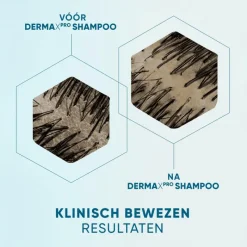 Sale Head and Shoulders Head & Shoulders Derma X Pro Kalmeert Anti-Roos Shampoo 250 ML