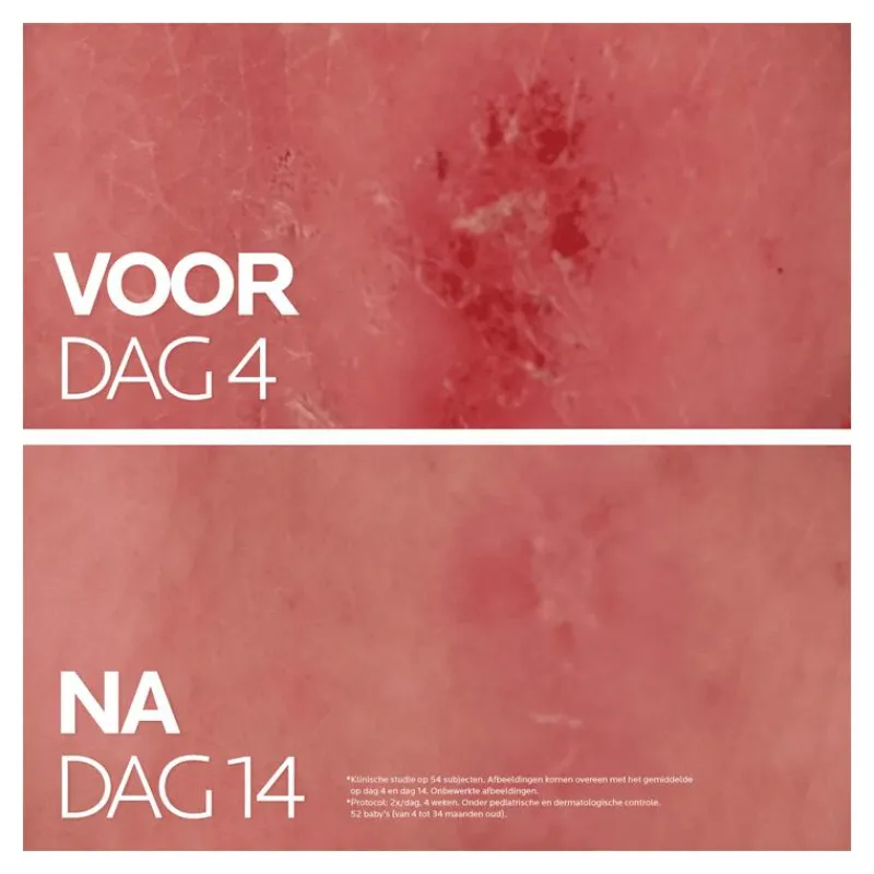 Outlet La Roche-Posay Cicaplast Balsem B5 Gevoelige Huid 40 ML