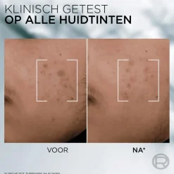 Online L'Oréal Paris L'Oreal Men Expert Derma Control Serum 30ML