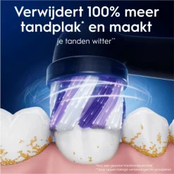 Online Oral-B iO Radiant White Opzetborstels Zwart 4 Stuks 26