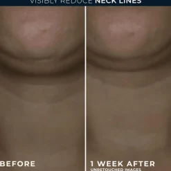 Outlet RoC Derm Correxion Contour Cream 50 ML