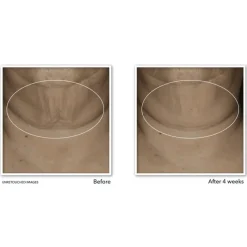 Outlet RoC Derm Correxion Firming Serum Stick